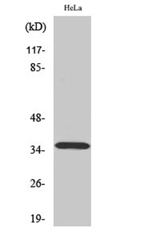 ELOVL4 rabbit pAb Antibody