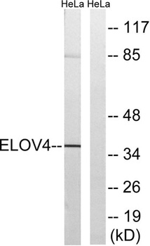 ELOVL4 rabbit pAb Antibody