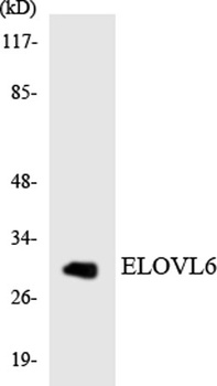 ELOVL6 rabbit pAb Antibody