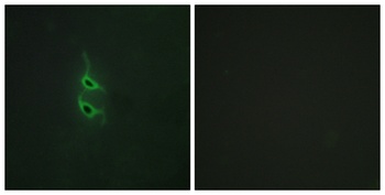 Endo180 rabbit pAb Antibody