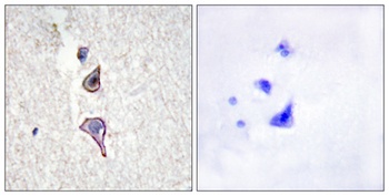 Endo180 rabbit pAb Antibody