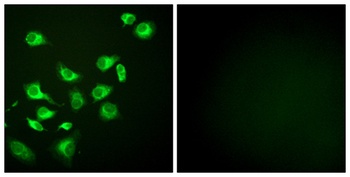 Endoplasmin rabbit pAb Antibody
