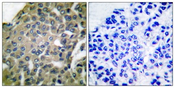 Endoplasmin rabbit pAb Antibody