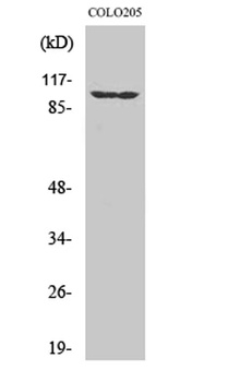 EphA1 rabbit pAb Antibody