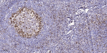 EphA1 rabbit pAb Antibody