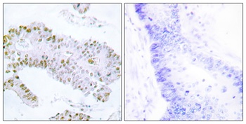 ERF rabbit pAb Antibody
