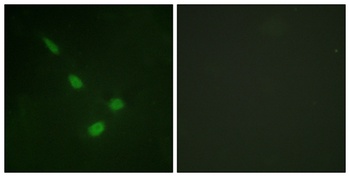 ERK 8 rabbit pAb Antibody