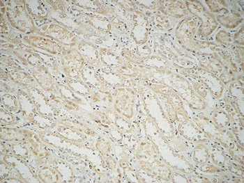 Fatty Acid Synthase rabbit pAb Antibody