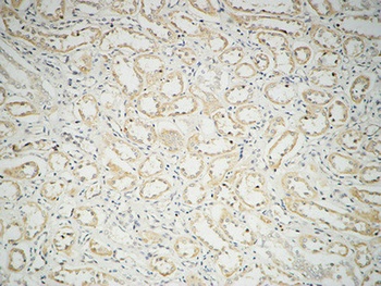 Fatty Acid Synthase rabbit pAb Antibody