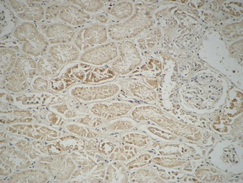 Fatty Acid Synthase rabbit pAb Antibody