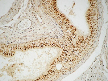 FEN-1 rabbit pAb Antibody