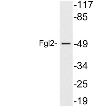 Fgl2 rabbit pAb Antibody
