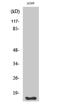 Fhit rabbit pAb Antibody
