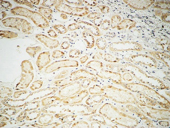 Fhit rabbit pAb Antibody