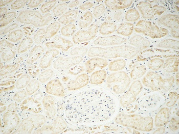 Fhit rabbit pAb Antibody