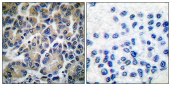 Filamin 1 rabbit pAb Antibody