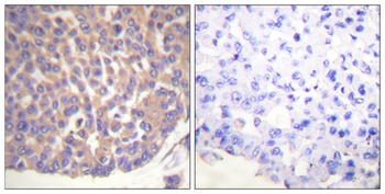 Filamin 1 rabbit pAb Antibody