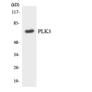 Fnk rabbit pAb Antibody