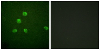 Fos B rabbit pAb Antibody