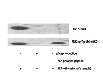FRS2 rabbit pAb Antibody
