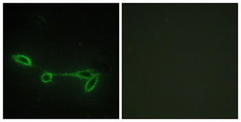 Fucokinase rabbit pAb Antibody