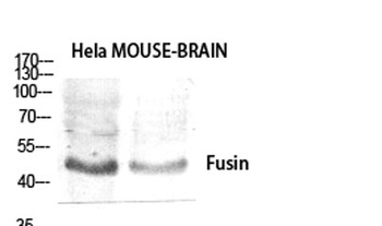 Fusin rabbit pAb Antibody