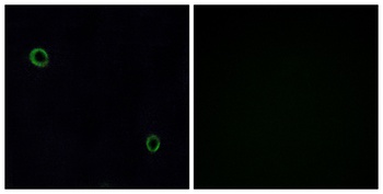 Fusin rabbit pAb Antibody