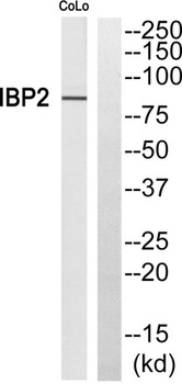 Fyb rabbit pAb Antibody