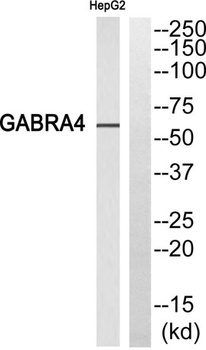 GABAA Rα4 rabbit pAb Antibody