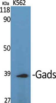 Gads rabbit pAb Antibody