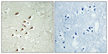 GCP5 rabbit pAb Antibody