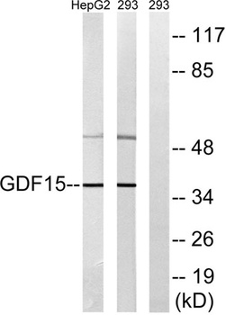 GDF-15 rabbit pAb Antibody