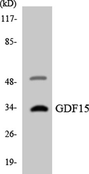 GDF-15 rabbit pAb Antibody