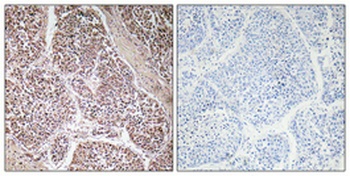 GDF-9 rabbit pAb Antibody