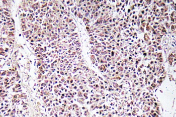 GDF-9 rabbit pAb Antibody