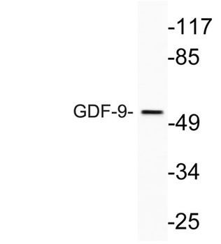 GDF-9 rabbit pAb Antibody