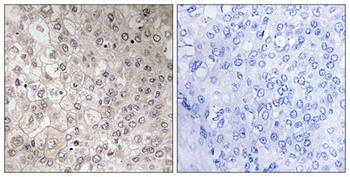 GIPR rabbit pAb Antibody