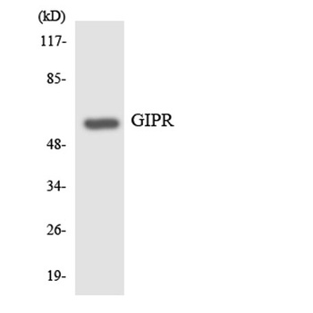 GIPR rabbit pAb Antibody