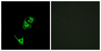GLP-1R rabbit pAb Antibody