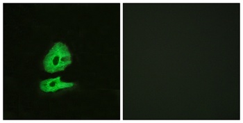 Glucagon Receptor rabbit pAb Antibody