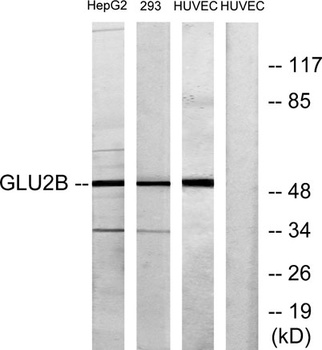 Glucosidase IIβ rabbit pAb Antibody