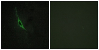 Granzyme K Rabbit Polyclonal Antibody
