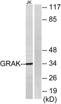 Granzyme K Rabbit Polyclonal Antibody