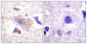GRB10 rabbit pAb Antibody