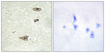 GRK 1 rabbit pAb Antibody