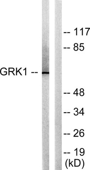 GRK 1 rabbit pAb Antibody