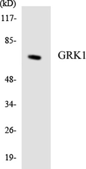 GRK 1 rabbit pAb Antibody