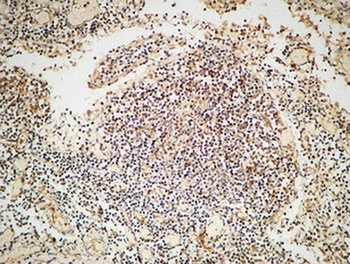 GRK 2 rabbit pAb Antibody
