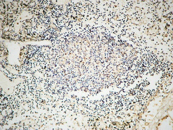 GTBP rabbit pAb Antibody