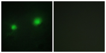 HBO1 rabbit pAb Antibody
